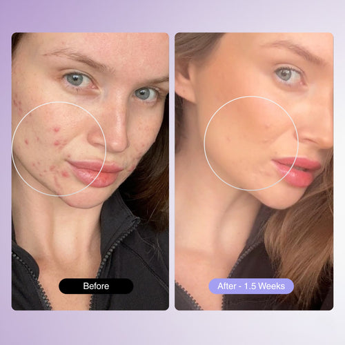 PureGlow Frequency Wand