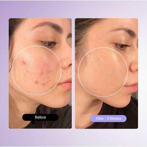 PureGlow Frequency Wand