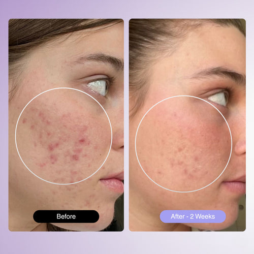 PureGlow Frequency Wand