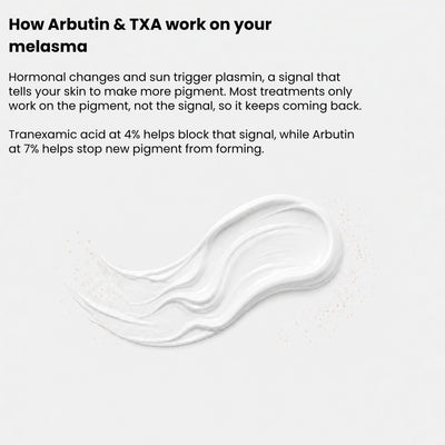 Fade Your Melasma With Arbutin 7% + Tranexamic Acid 4%