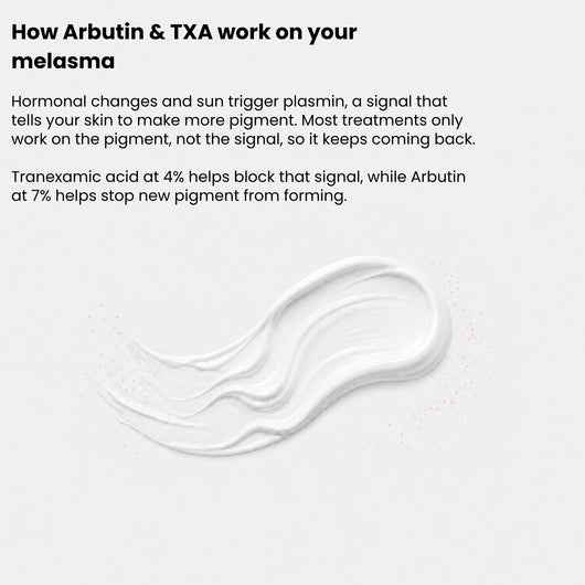 Fade Your Melasma With Arbutin 7% + Tranexamic Acid 4%