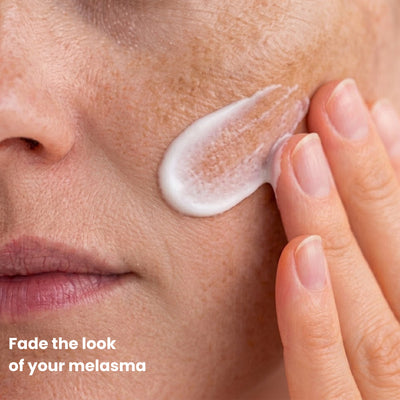Melasma Fade Cream