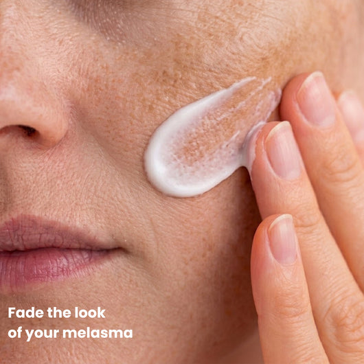 Melasma Fade Cream