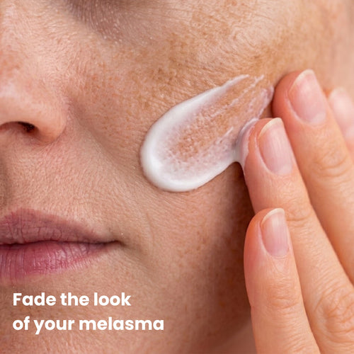 Melasma Fade Cream