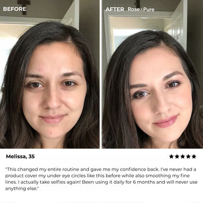 Luminous Eye Corrector
