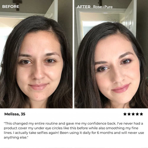 Luminous Eye Corrector
