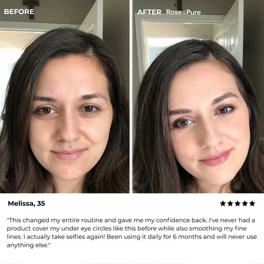 Luminous Eye Corrector
