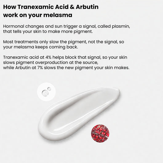 Fade Your Melasma With Arbutin 7% + Tranexamic Acid 4%