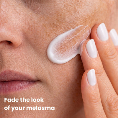 Fade Your Melasma With Arbutin 7% + Tranexamic Acid 4%