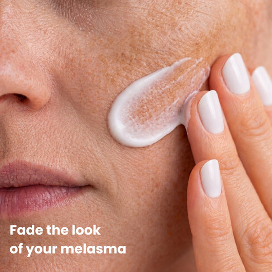 Fade Your Melasma With Arbutin 7% + Tranexamic Acid 4%